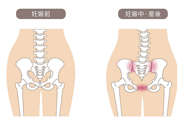 マタニティ整体