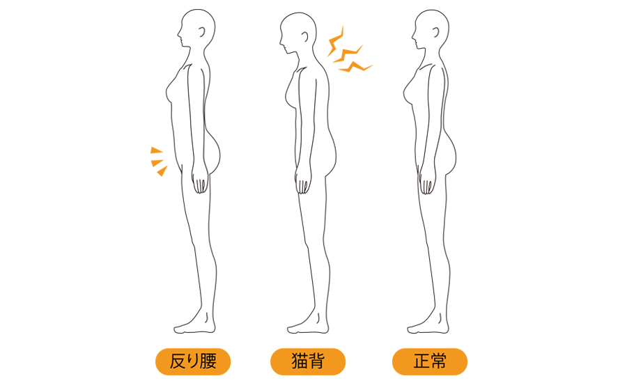 猫背・姿勢矯正